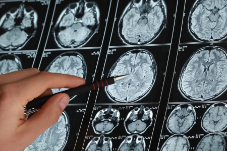 Jak przygotować się do tomografii komputerowej? Kompletny poradnik pacjenta